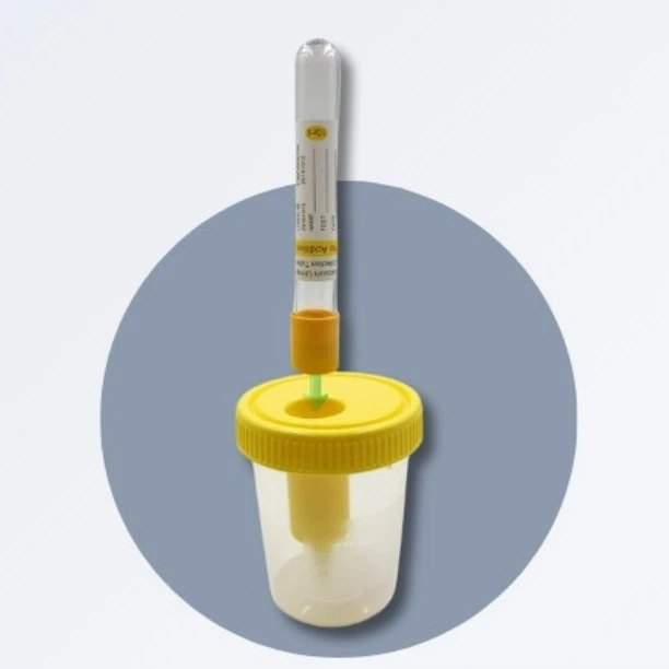 Vacuum Urine Specimen Cups 20ml-150ml
